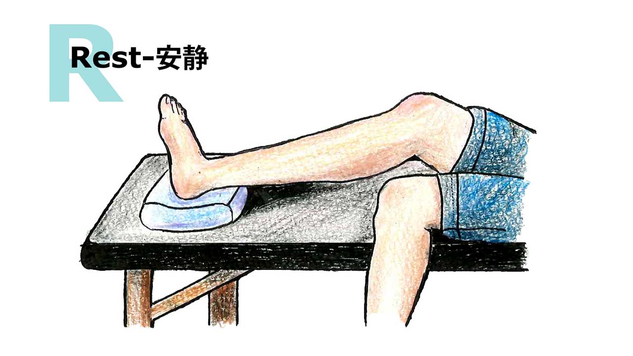 マラソンでのケガを軽減するには ランニングサポーターの役割 マラソンでのケガを軽減するには ランニングサポーターの役割